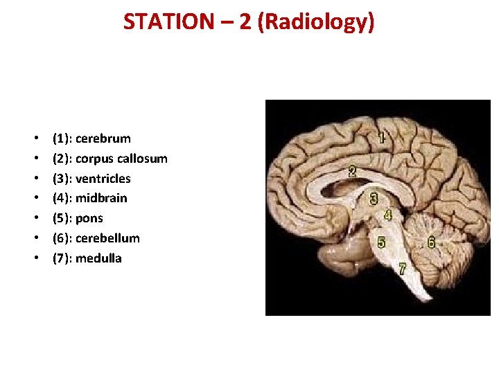 STATION – 2 (Radiology) • • (1): cerebrum (2): corpus callosum (3): ventricles (4):