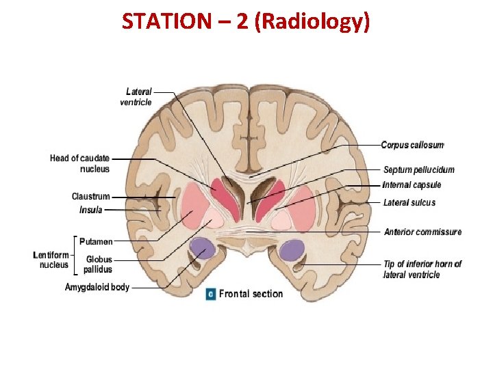 STATION – 2 (Radiology) 