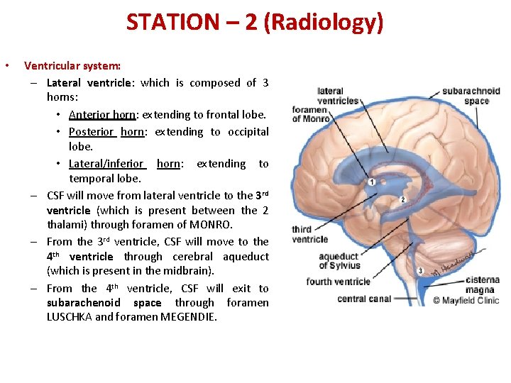 STATION – 2 (Radiology) • Ventricular system: – Lateral ventricle: which is composed of