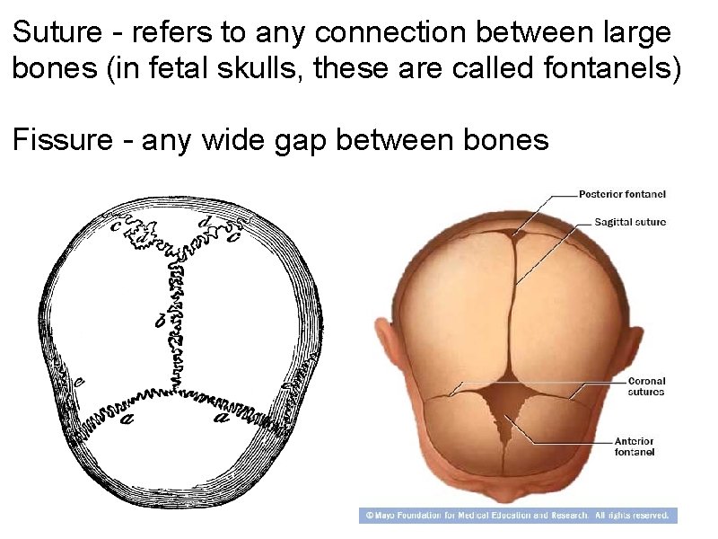 Suture - refers to any connection between large bones (in fetal skulls, these are