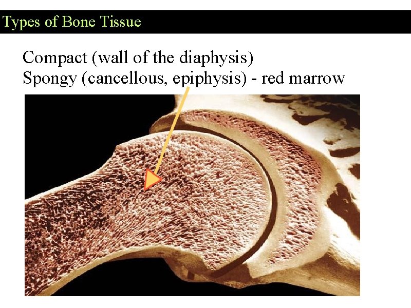 Types of Bone Tissue Compact (wall of the diaphysis) Spongy (cancellous, epiphysis) - red
