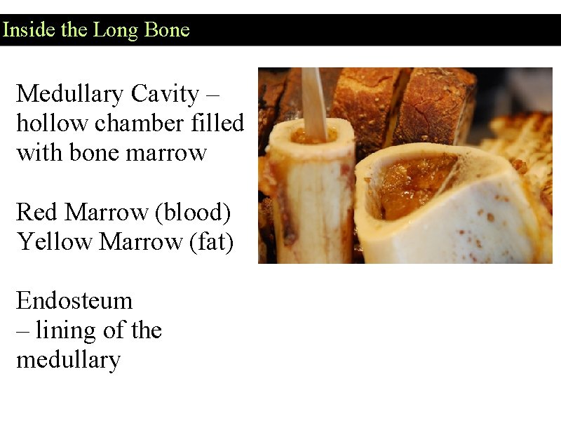 Inside the Long Bone Medullary Cavity – hollow chamber filled with bone marrow Red