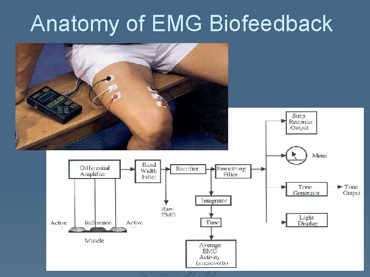 Anatomy of EMG Biofeedback 