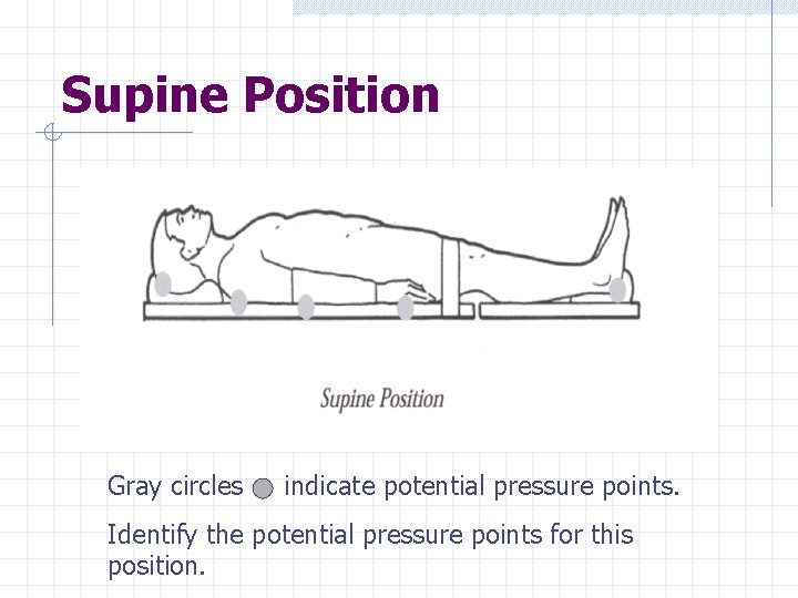 Supine Position Gray circles indicate potential pressure points. Identify the potential pressure points for