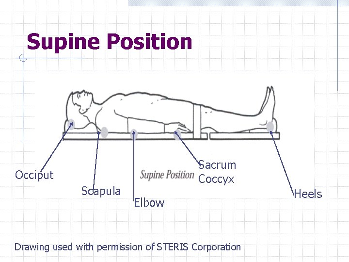 Supine Position Sacrum Coccyx Occiput Scapula Elbow Drawing used with permission of STERIS Corporation