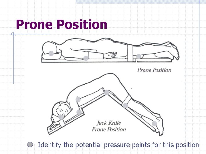 Prone Position Identify the potential pressure points for this position 