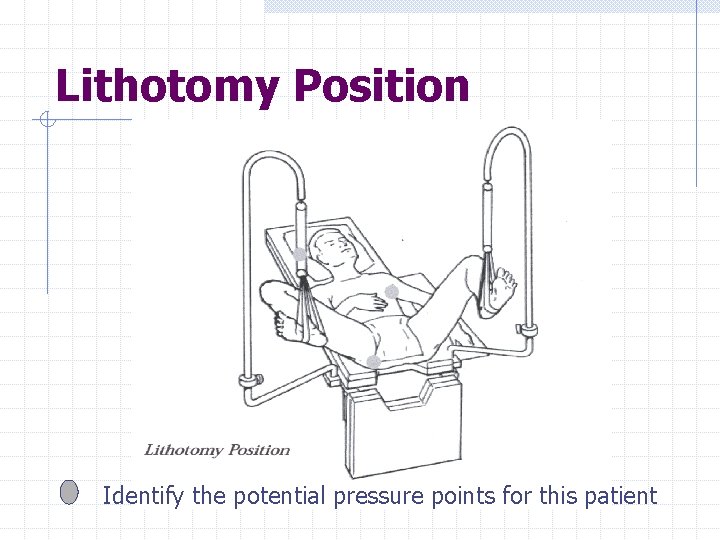 Lithotomy Position Identify the potential pressure points for this patient 