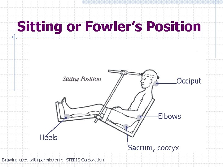 Sitting or Fowler’s Position Occiput Elbows Heels Sacrum, coccyx Drawing used with permission of