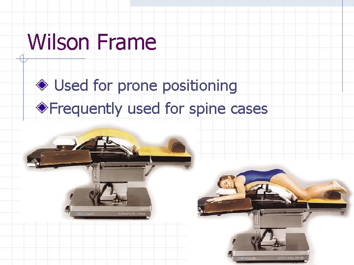 Wilson Frame Used for prone positioning Frequently used for spine cases 