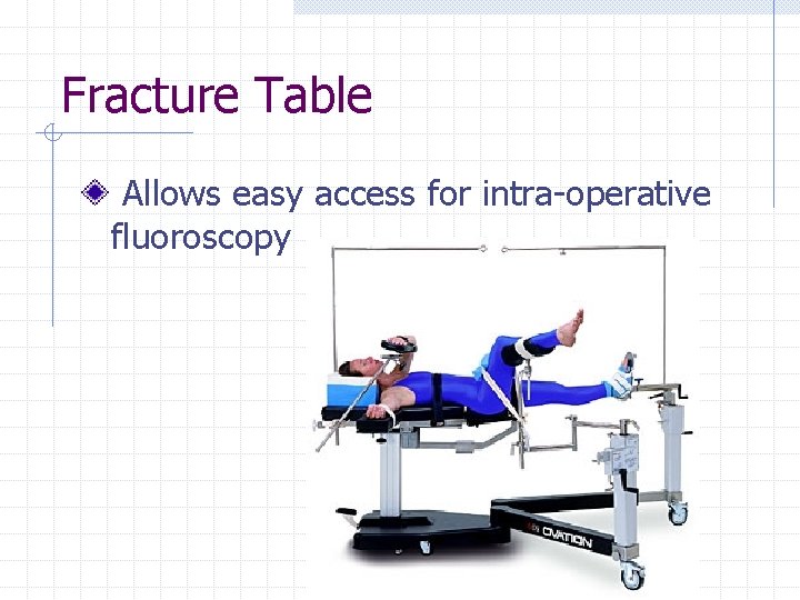 Fracture Table Allows easy access for intra-operative fluoroscopy 