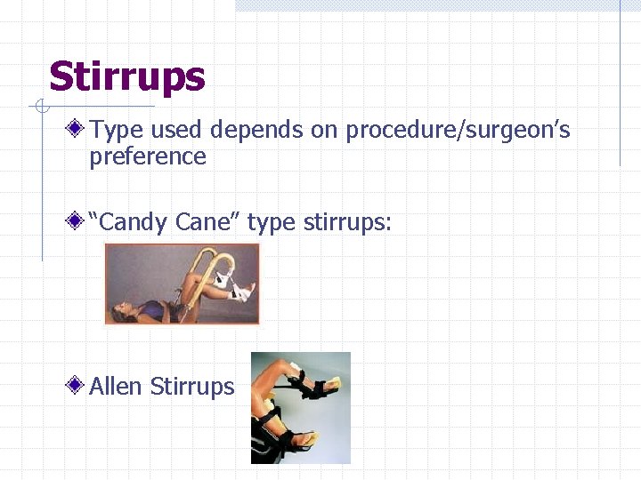 Stirrups Type used depends on procedure/surgeon’s preference “Candy Cane” type stirrups: Allen Stirrups 