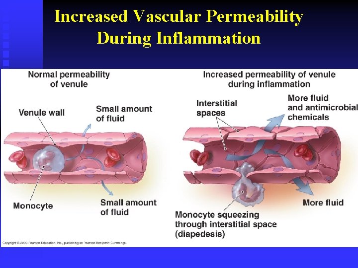 Increased Vascular Permeability During Inflammation 