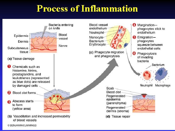 Process of Inflammation 