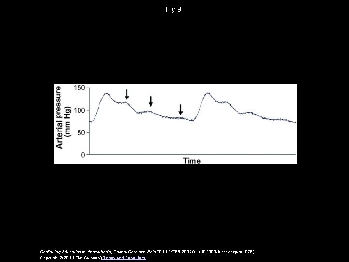 Fig 9 Continuing Education in Anaesthesia, Critical Care and Pain 2014 14285 -290 DOI: