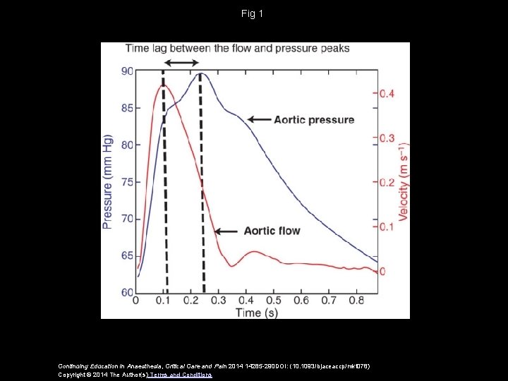 Fig 1 Continuing Education in Anaesthesia, Critical Care and Pain 2014 14285 -290 DOI: