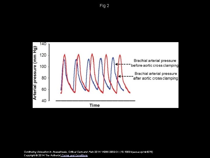 Fig 2 Continuing Education in Anaesthesia, Critical Care and Pain 2014 14285 -290 DOI: