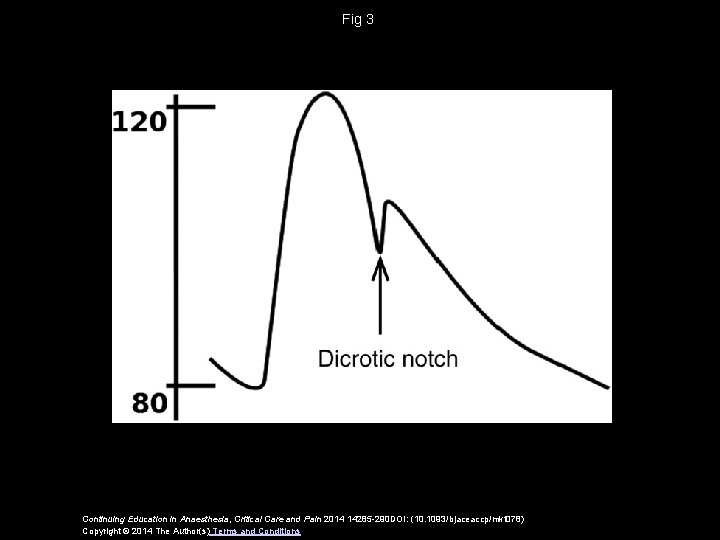 Fig 3 Continuing Education in Anaesthesia, Critical Care and Pain 2014 14285 -290 DOI: