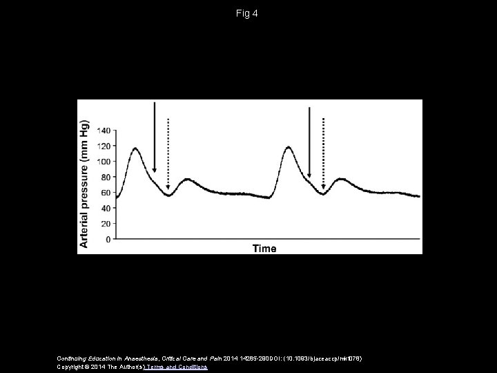 Fig 4 Continuing Education in Anaesthesia, Critical Care and Pain 2014 14285 -290 DOI: