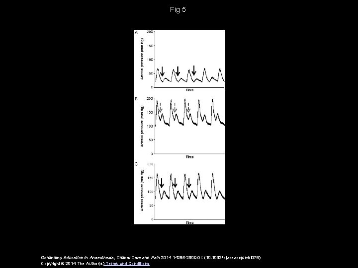 Fig 5 Continuing Education in Anaesthesia, Critical Care and Pain 2014 14285 -290 DOI:
