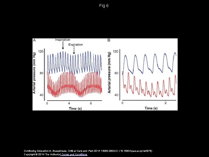 Fig 6 Continuing Education in Anaesthesia, Critical Care and Pain 2014 14285 -290 DOI: