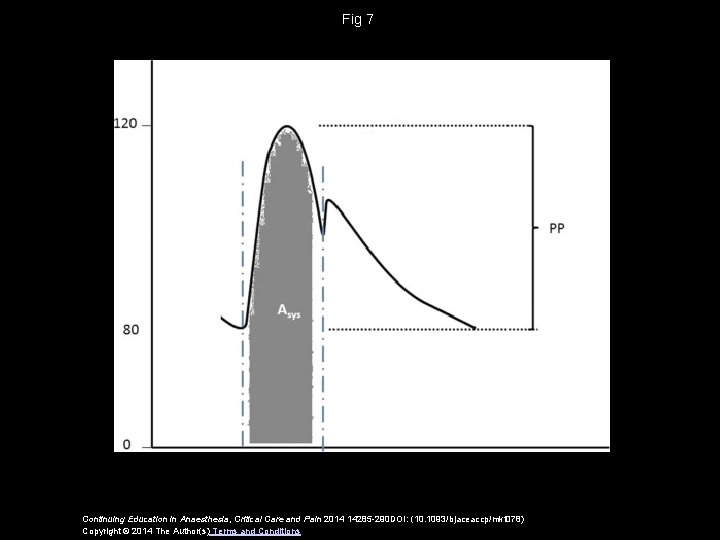 Fig 7 Continuing Education in Anaesthesia, Critical Care and Pain 2014 14285 -290 DOI: