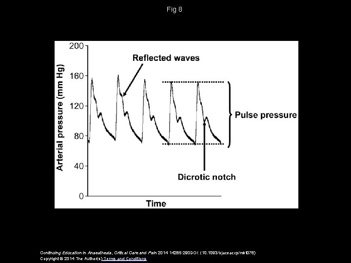 Fig 8 Continuing Education in Anaesthesia, Critical Care and Pain 2014 14285 -290 DOI: