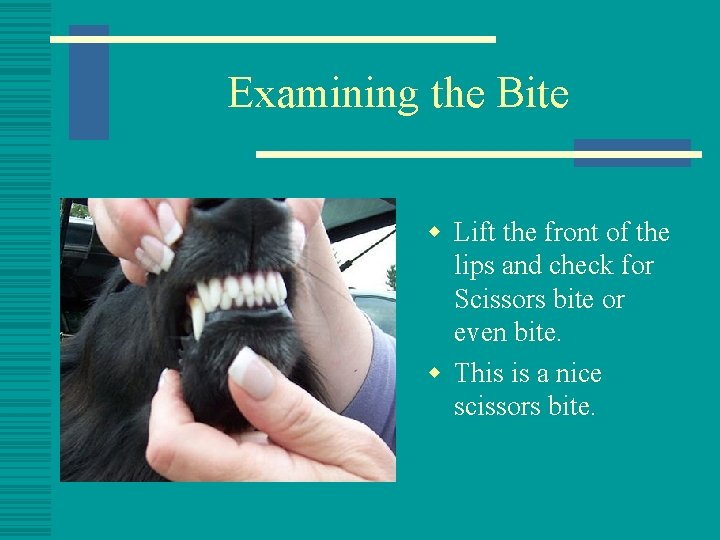 Examining the Bite w Lift the front of the lips and check for Scissors