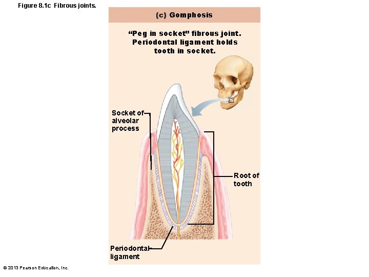 Figure 8. 1 c Fibrous joints. Gomphosis “Peg in socket” fibrous joint. Periodontal ligament