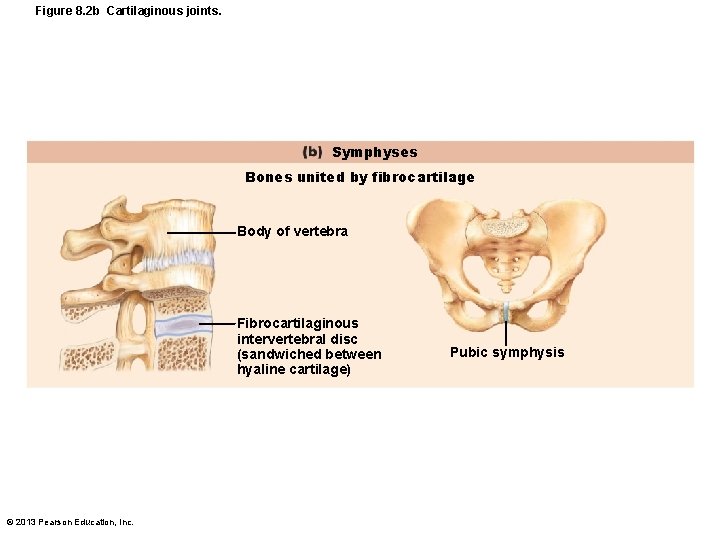 Figure 8. 2 b Cartilaginous joints. Symphyses Bones united by fibrocartilage Body of vertebra