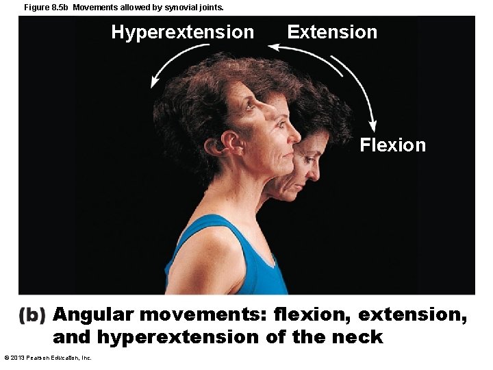 Figure 8. 5 b Movements allowed by synovial joints. Hyperextension Extension Flexion Angular movements: