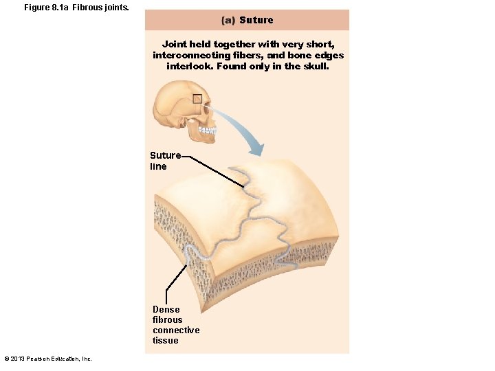Figure 8. 1 a Fibrous joints. Suture Joint held together with very short, interconnecting