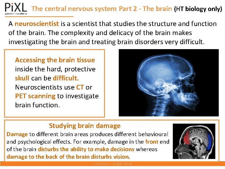 The central nervous system Part 2 - The brain (HT biology only) A neuroscientist