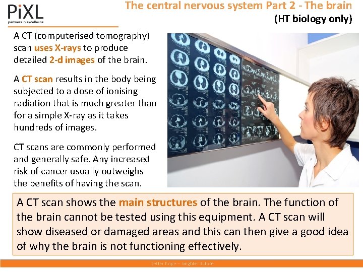 The central nervous system Part 2 - The brain (HT biology only) A CT