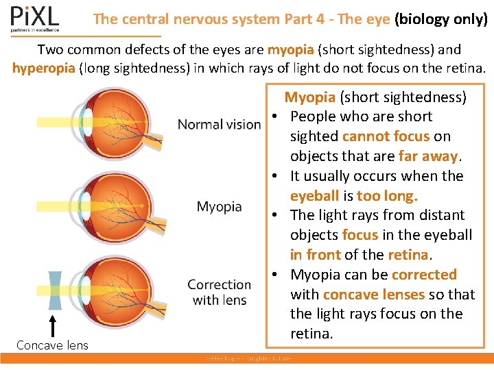 The central nervous system Part 4 - The eye (biology only) Two common defects