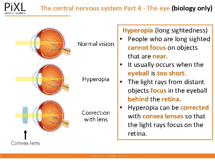 The central nervous system Part 4 - The eye (biology only) Hyperopia (long sightedness)