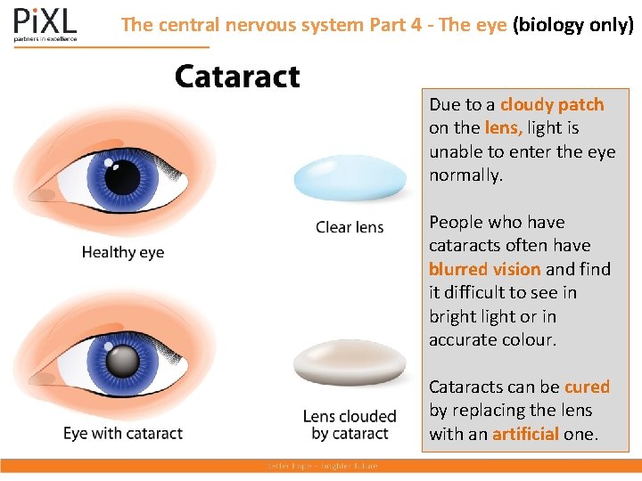 The central nervous system Part 4 - The eye (biology only) Due to a