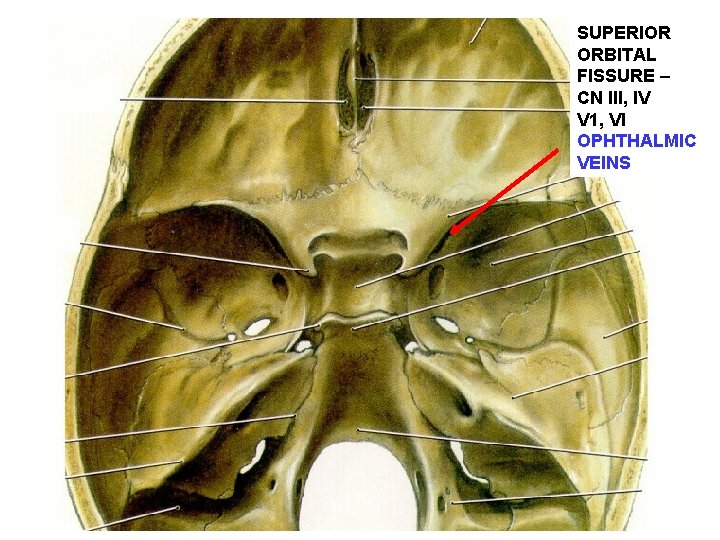 SUPERIOR ORBITAL FISSURE – CN III, IV V 1, VI OPHTHALMIC VEINS 