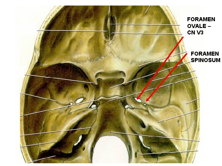 FORAMEN OVALE – CN V 3 FORAMEN SPINOSUM 