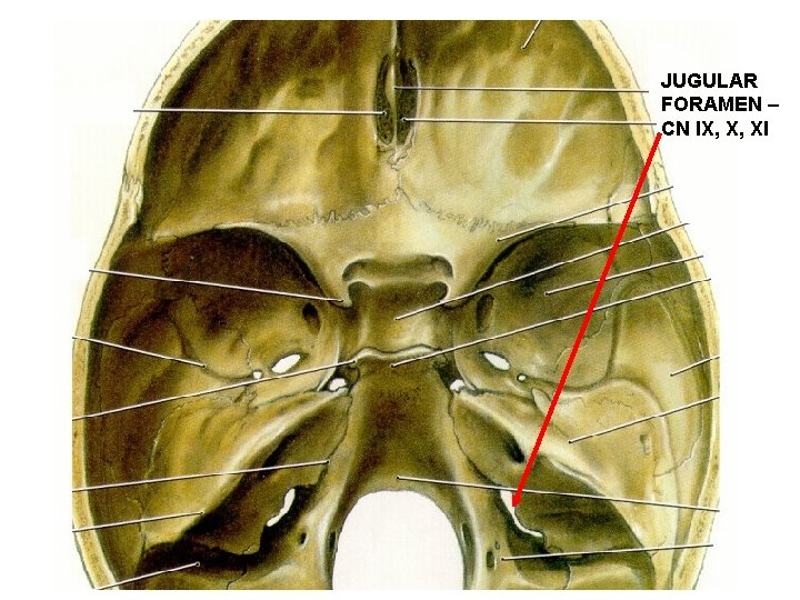 JUGULAR FORAMEN – CN IX, X, XI 