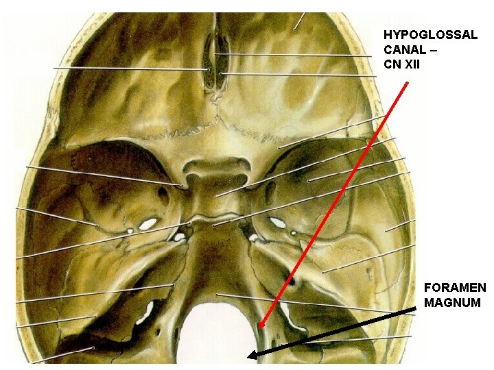 HYPOGLOSSAL CANAL – CN XII FORAMEN MAGNUM 