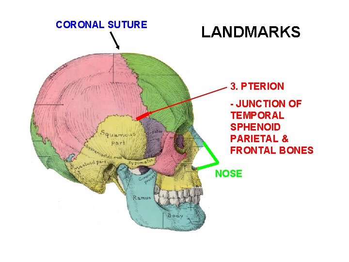 CORONAL SUTURE LANDMARKS 3. PTERION - JUNCTION OF TEMPORAL SPHENOID PARIETAL & FRONTAL BONES