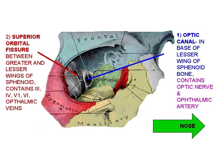 2) SUPERIOR ORBITAL FISSURE BETWEEN GREATER AND LESSER WINGS OF SPHENOID, CONTAINS III, IV,