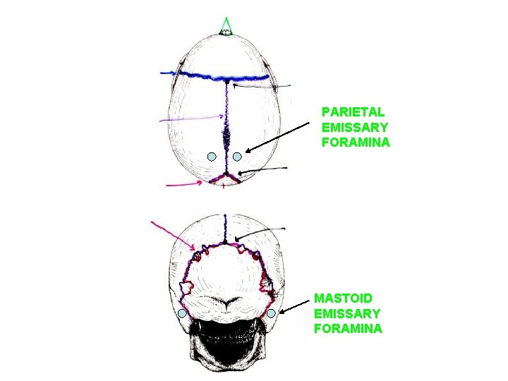 PARIETAL EMISSARY FORAMINA MASTOID EMISSARY FORAMINA 