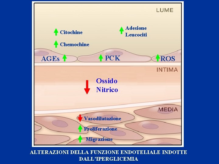 Adesione Leucociti Citochine Chemochine AGEs PCK ROS Ossido Nitrico Vasodilatazione Proliferazione Migrazione ALTERAZIONI DELLA