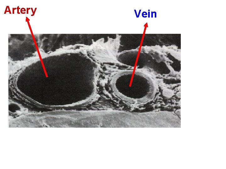 Artery Vein 