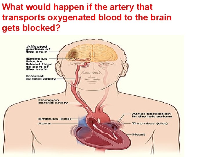 What would happen if the artery that transports oxygenated blood to the brain gets