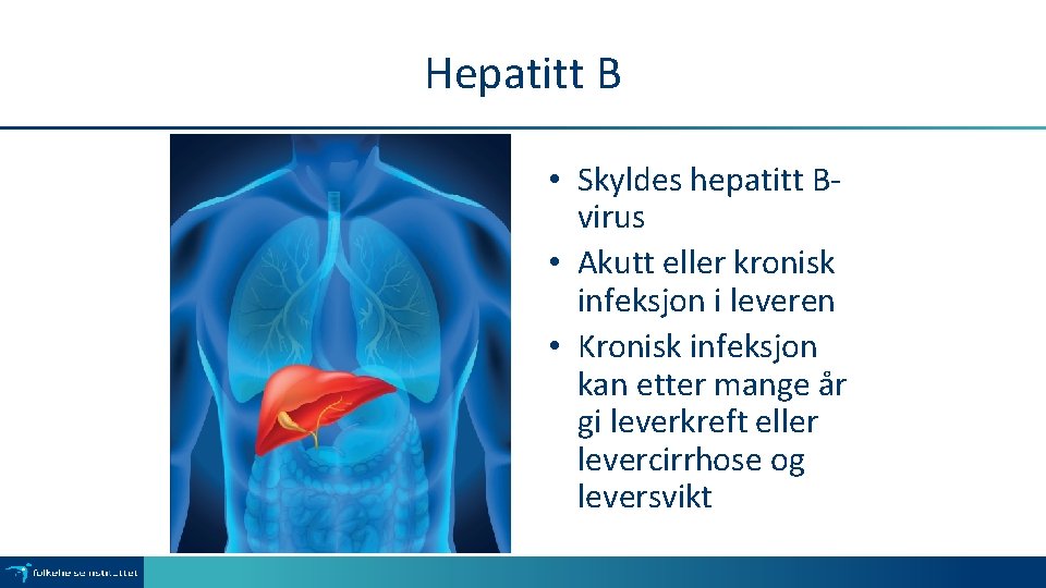 Hepatitt B • Skyldes hepatitt Bvirus • Akutt eller kronisk infeksjon i leveren •