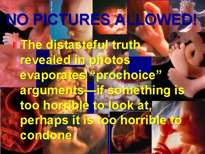 NO PICTURES ALLOWED! The distasteful truth revealed in photos evaporates “prochoice” arguments—if something is