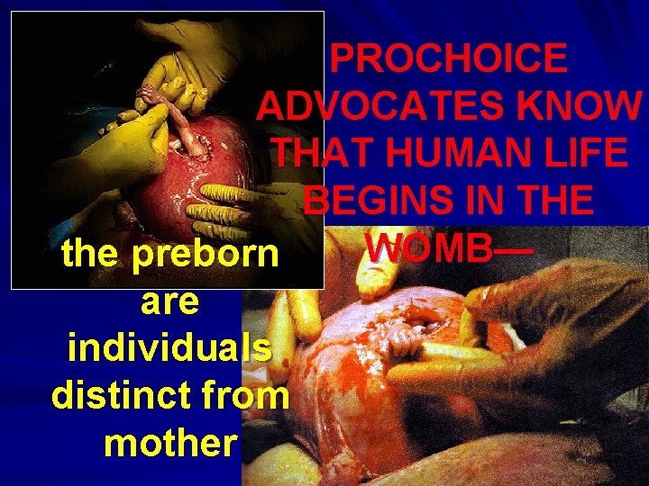PROCHOICE ADVOCATES KNOW THAT HUMAN LIFE BEGINS IN THE WOMB— the preborn are individuals