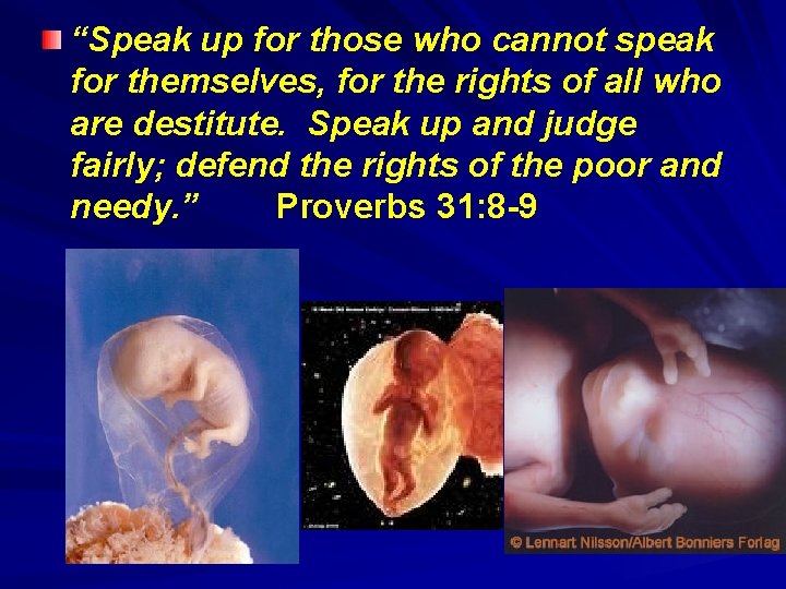 “Speak up for those who cannot speak for themselves, for the rights of all